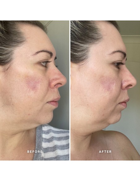 VA25-New-2-4 Week Trial_Emma Perry_80